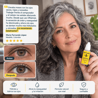 Gotas Oftalmiel Originales ° Mejora Tu Visión Con Gotas De Miel 🐝