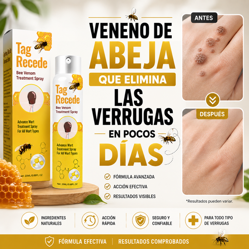 Veneno de Abeja Que Elimina Las Verrugas En Pocos Días 🐝